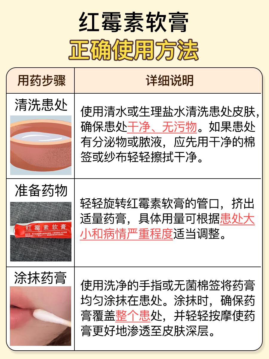 医生回答，红霉素软膏可以涂尿道口吗