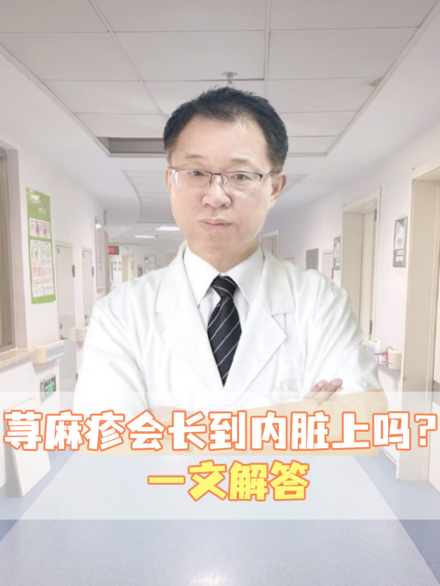荨麻疹会长到内脏上吗？一文解答