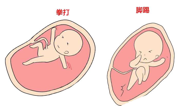 左枕前位的胎动特点图片
