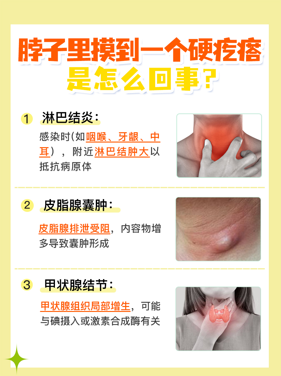 脖子里摸到一个豆大的硬疙瘩原因，带你解析