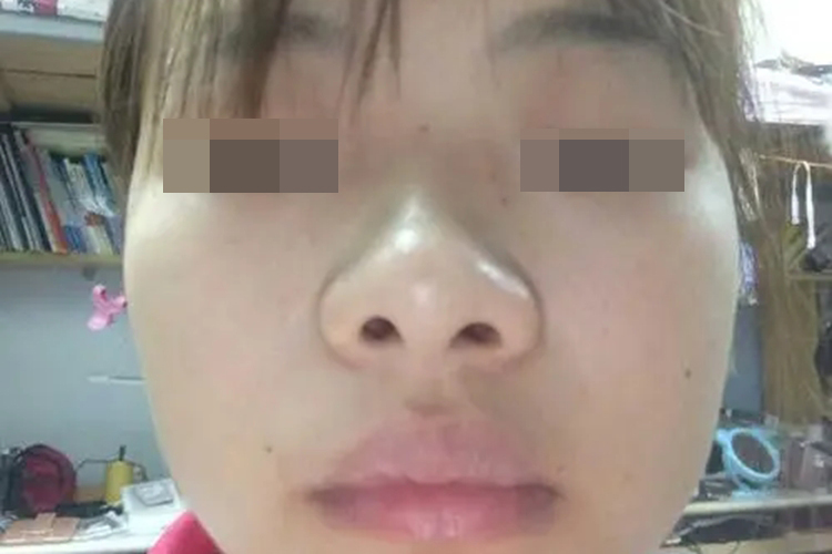 朝天鼻正面图 朝天鼻正面图