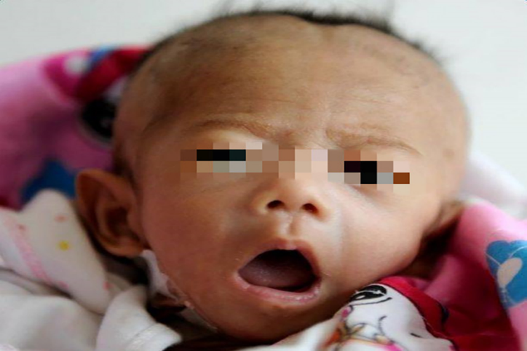 疳积面色发黄图 疳积面色发黄图