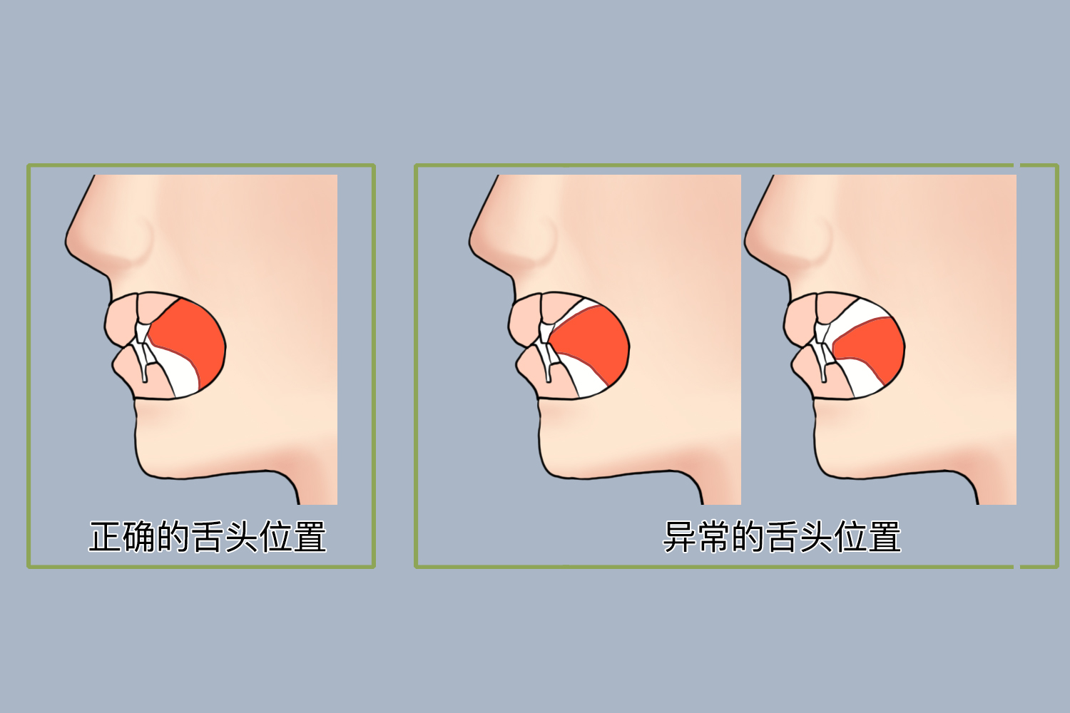 舌头摆放位置图