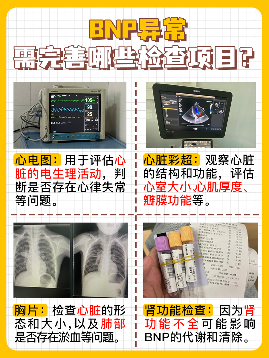 BNP正常值，你了解多少？关乎心脏健康的大事