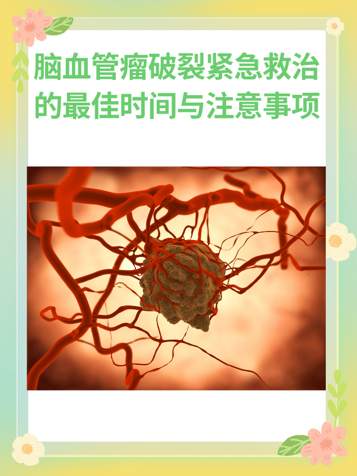 脑血管瘤破裂，紧急救治的最佳时间与注意事项