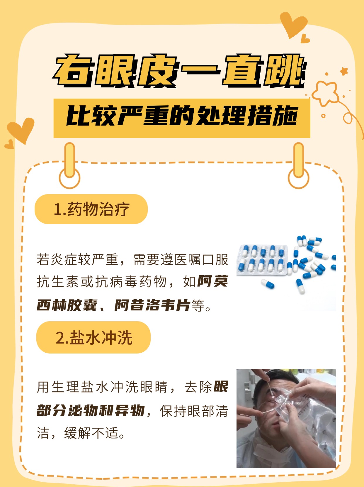 右眼皮一直跳什么预兆,医生辟谣!