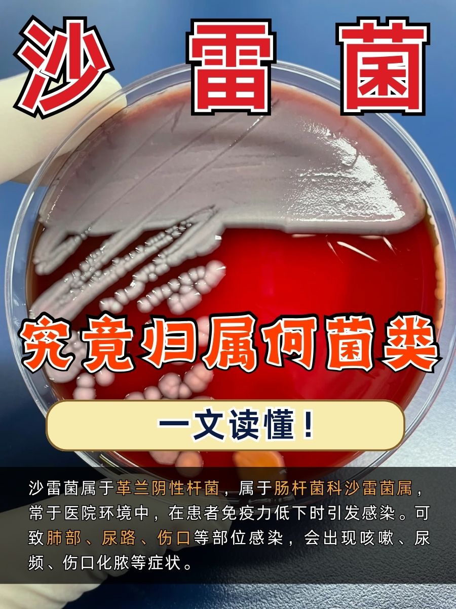 沙雷菌究竟归属何菌类?一文读懂!