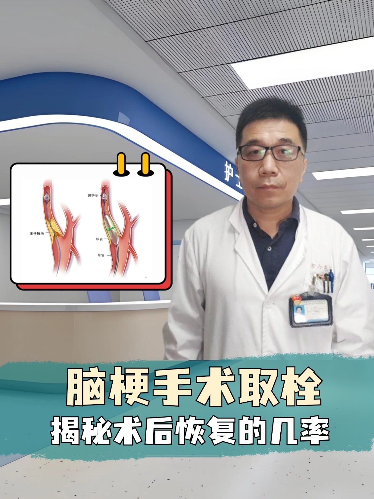 脑梗手术取栓:揭秘术后恢复的几率