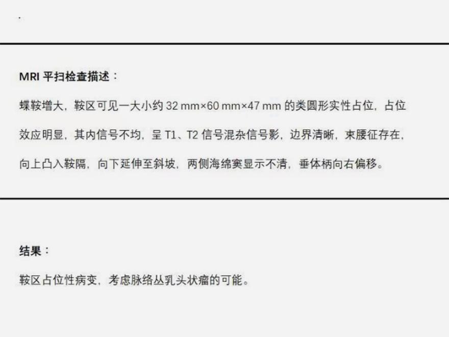 脉络丛乳头状瘤 （患者怀疑脉络丛乳头状瘤，手术治疗进行病理诊断！）.jpg