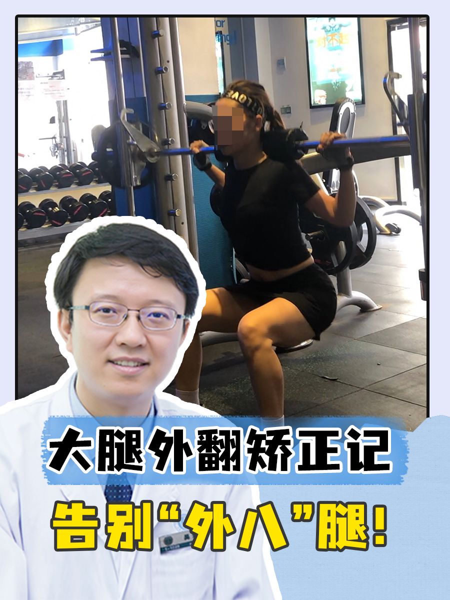 大腿外翻矫正记：告别“外八”腿！