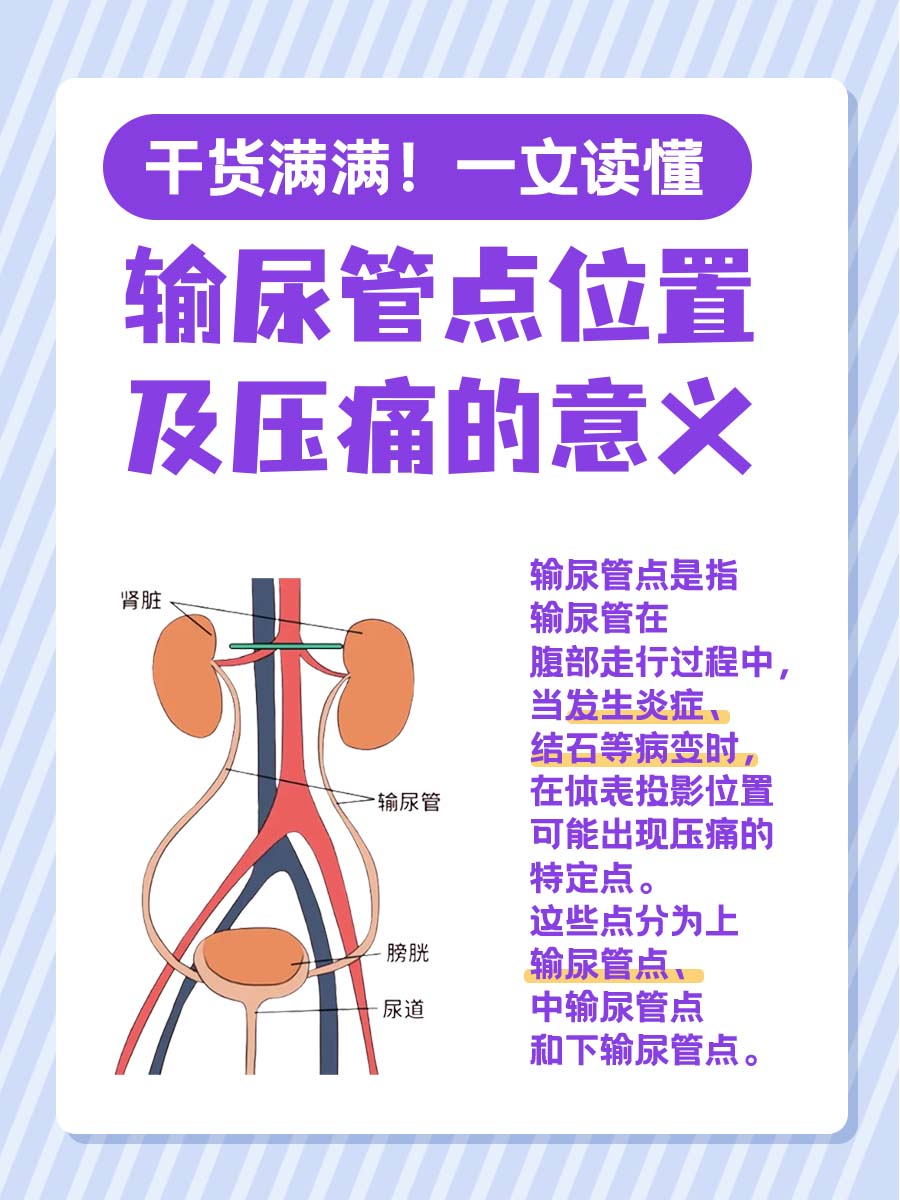 干货满满！一文读懂输尿管点位置及压痛的意义