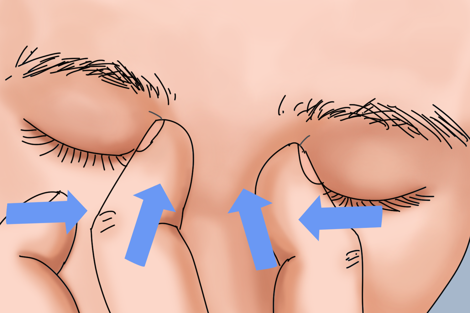 散瞳正确按压泪囊图片 本文由有来医生原创,经专业医师审核校对