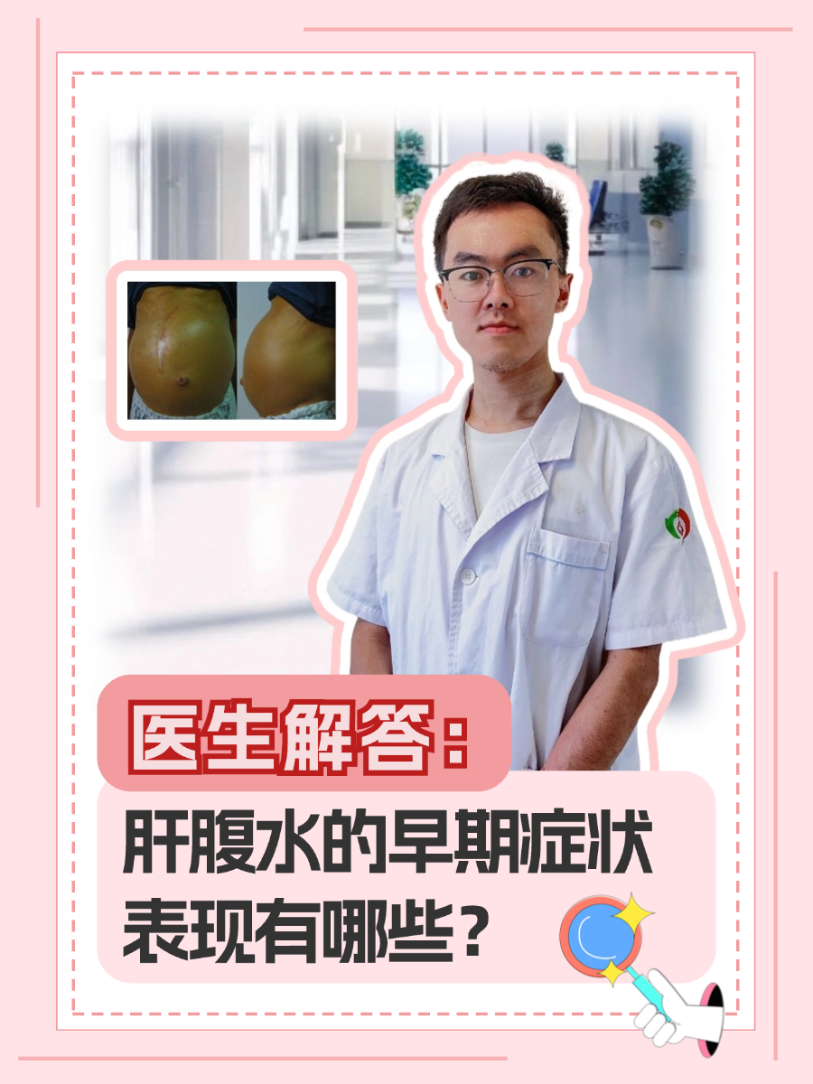 医生解答：肝腹水的早期症状表现有哪些？