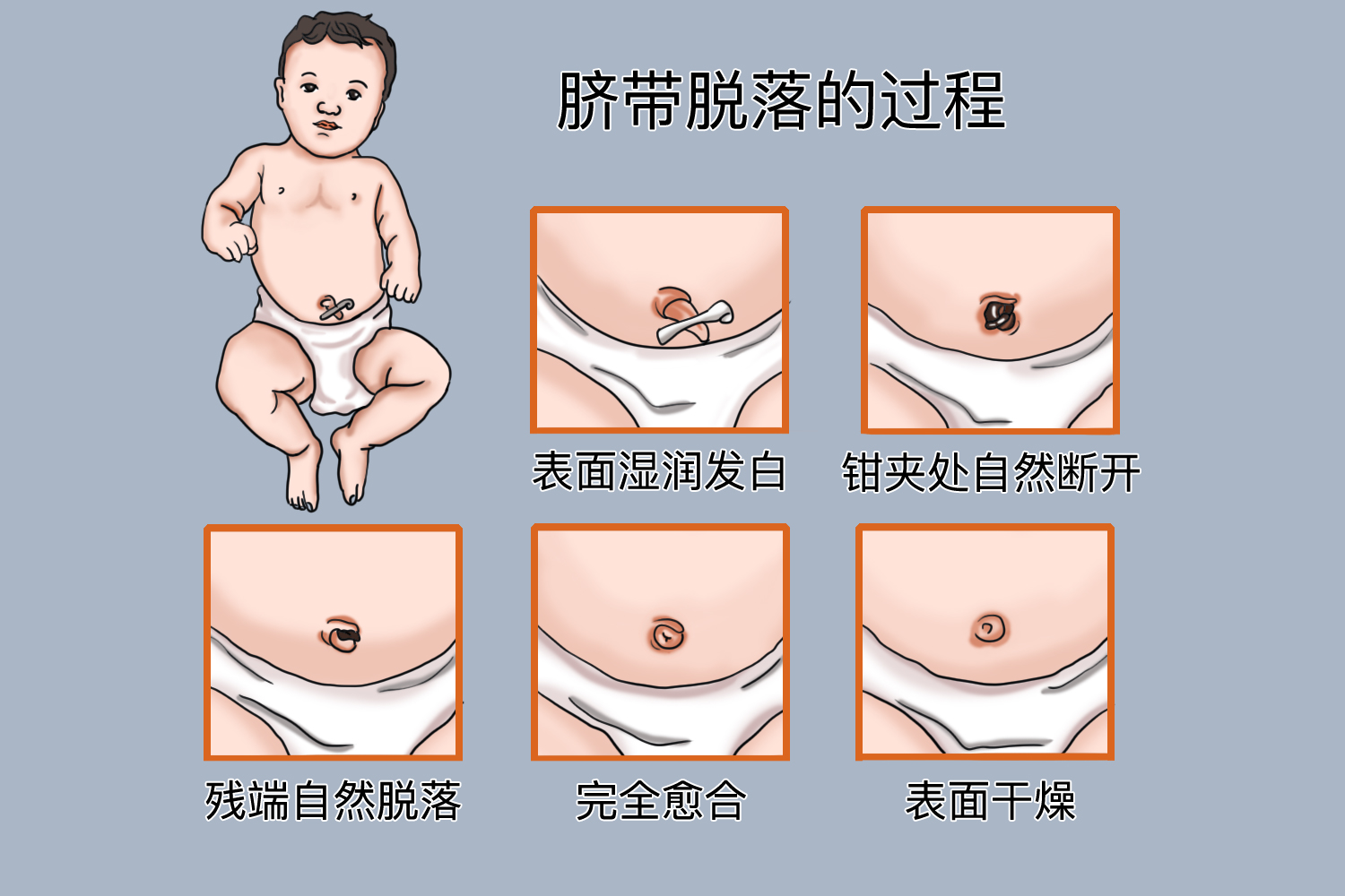 婴儿脐带脱落过程图