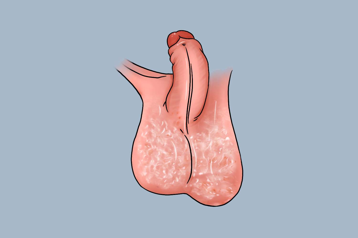 睾丸不一样大小正常吗