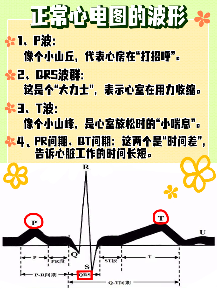 分享|一文教你秒懂正常心电图的波形图示!