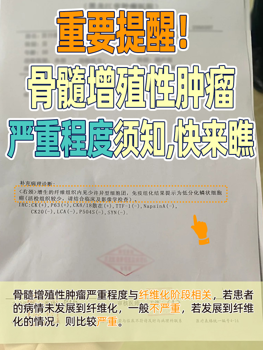 重要提醒！骨髓增殖性肿瘤严重程度须知，快来瞧