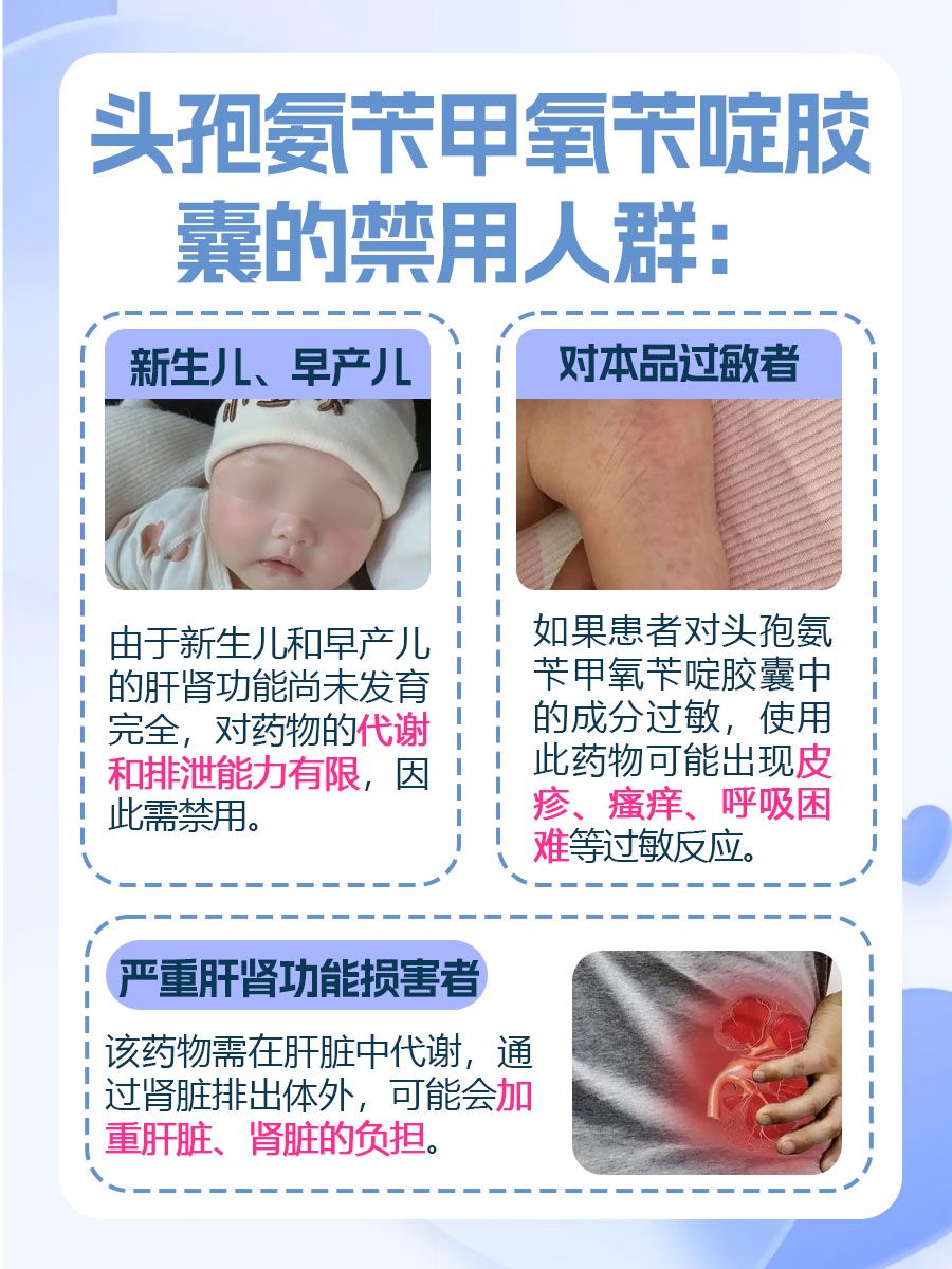 头孢氨苄甲氧苄啶胶囊有啥用？30秒来学会它！