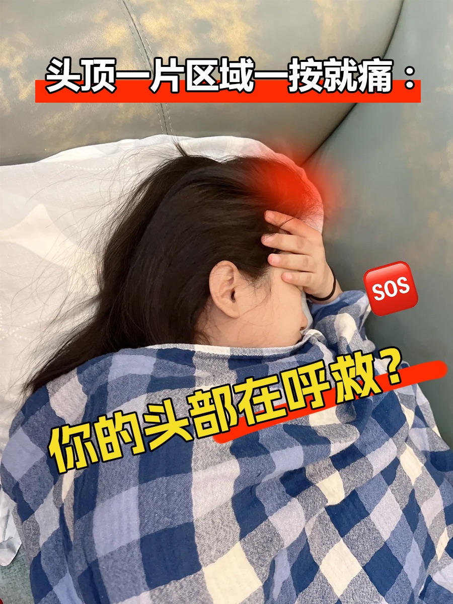 头顶一片区域一按就痛：你的头部在呼救？