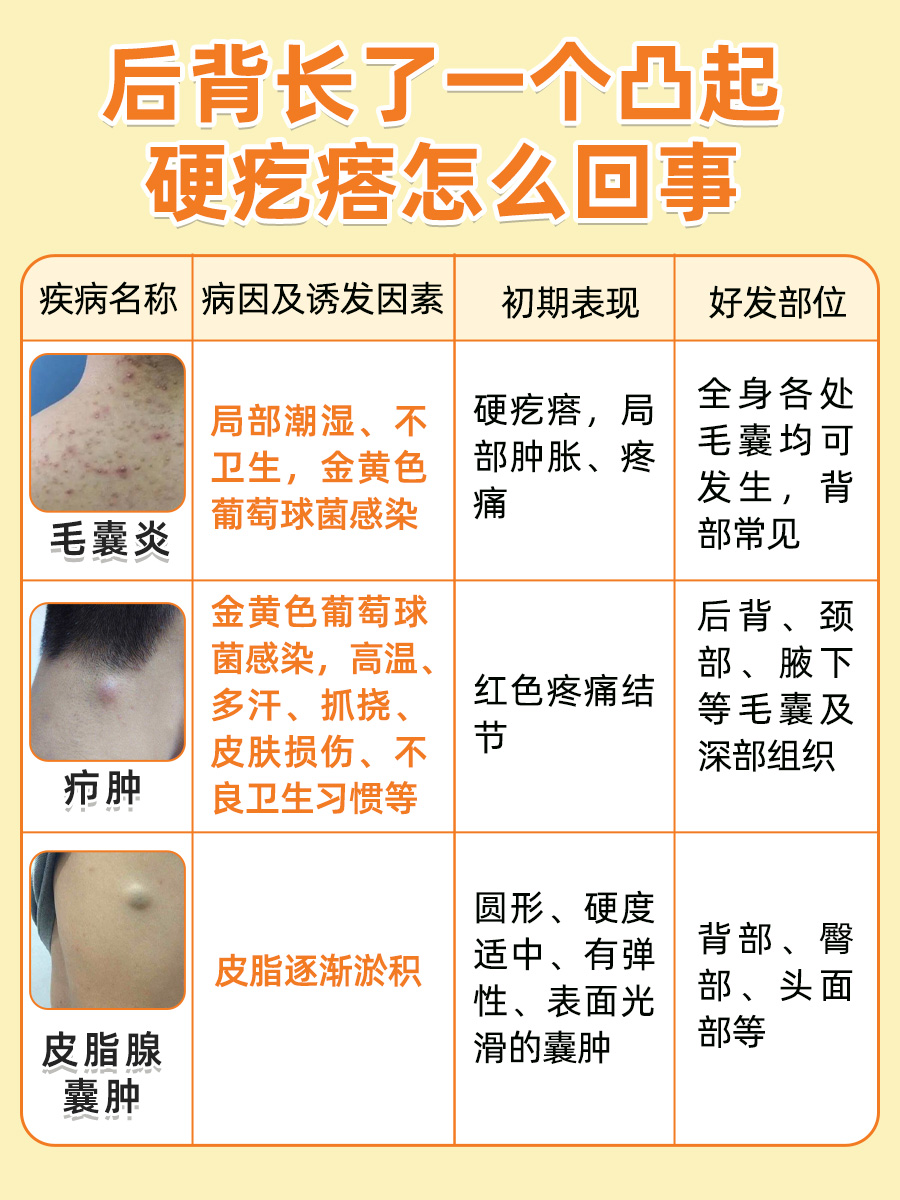 医生解读：后背硬疙瘩缘由与对策