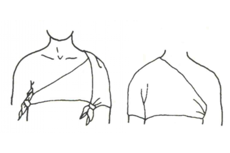 肩部包扎法图 肩部包扎法图