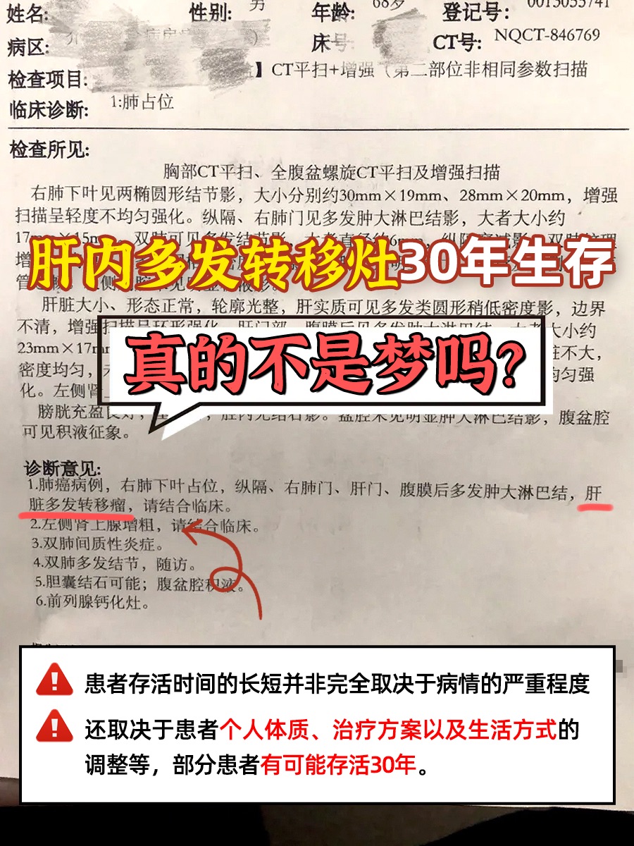 肝内多发转移灶30年生存，真的不是梦吗？