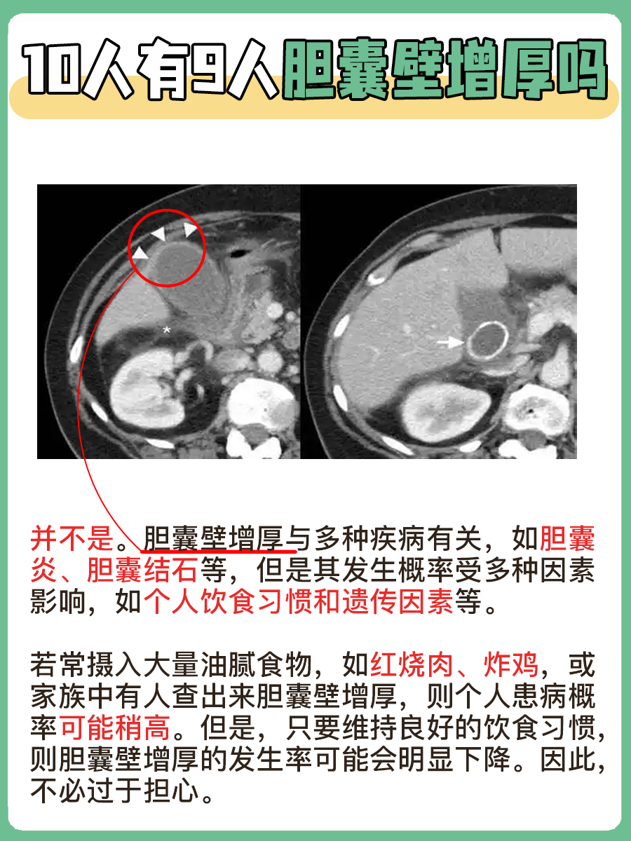 胆囊壁增厚，十人九遇？真的这么高发吗？