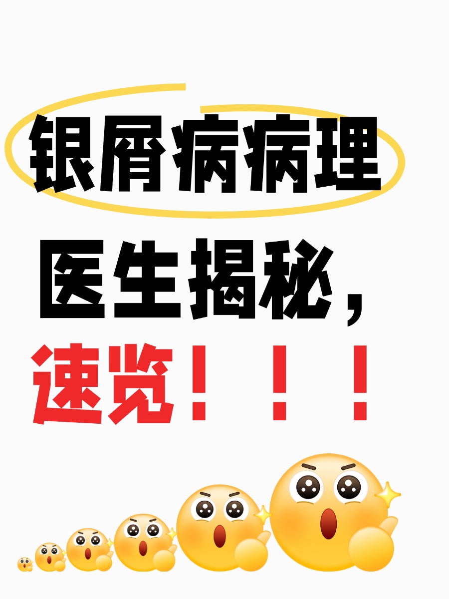 银屑病病理|医生揭秘,速览!!!