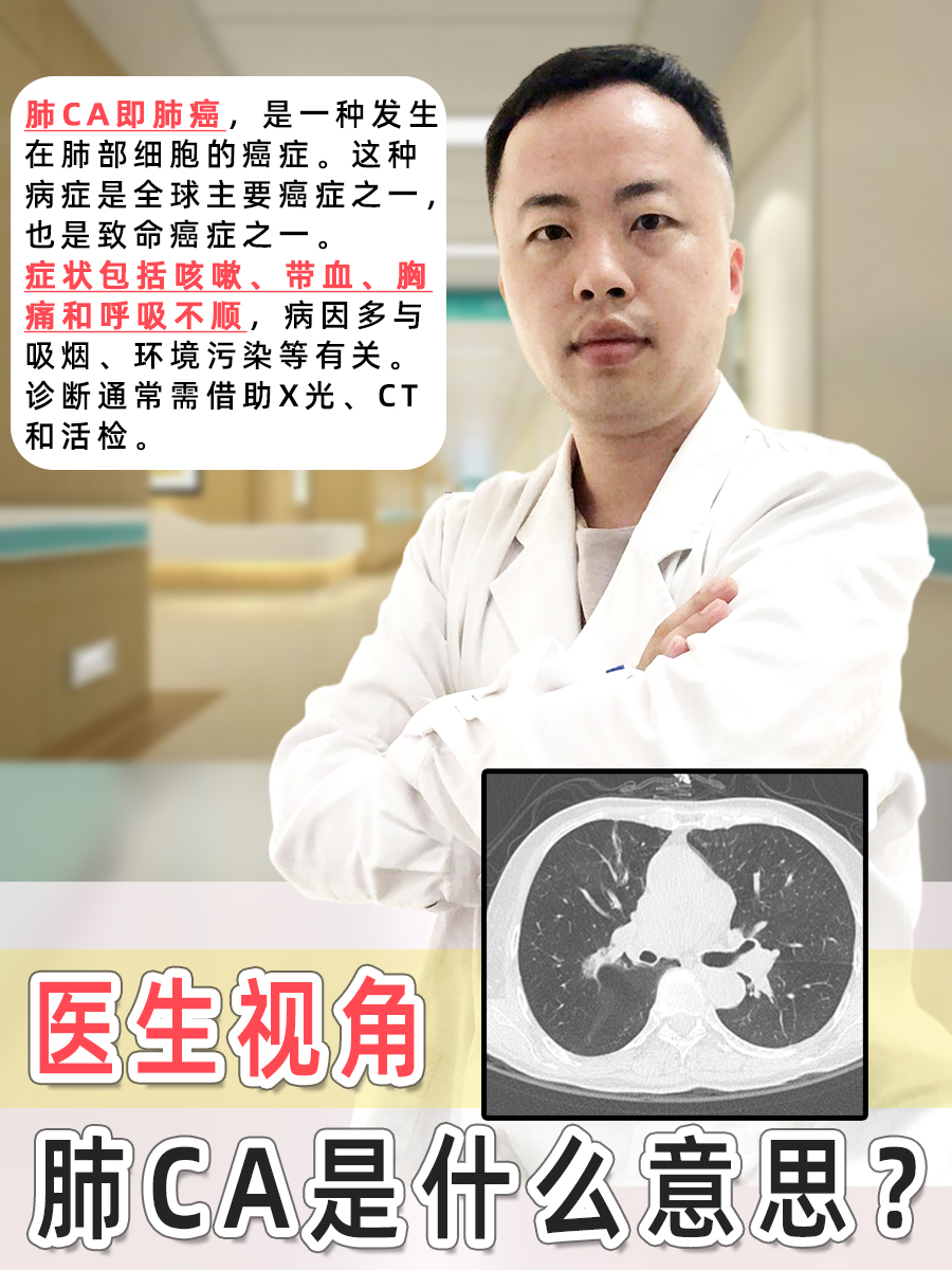 医生视角：肺CA是什么意思？