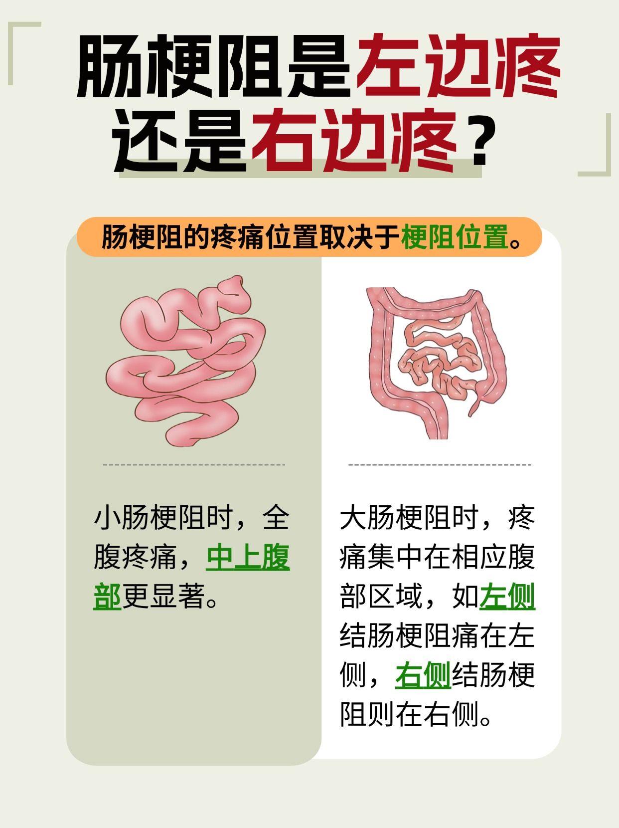 肠梗阻痛在何处？你是左边疼还是右边疼？