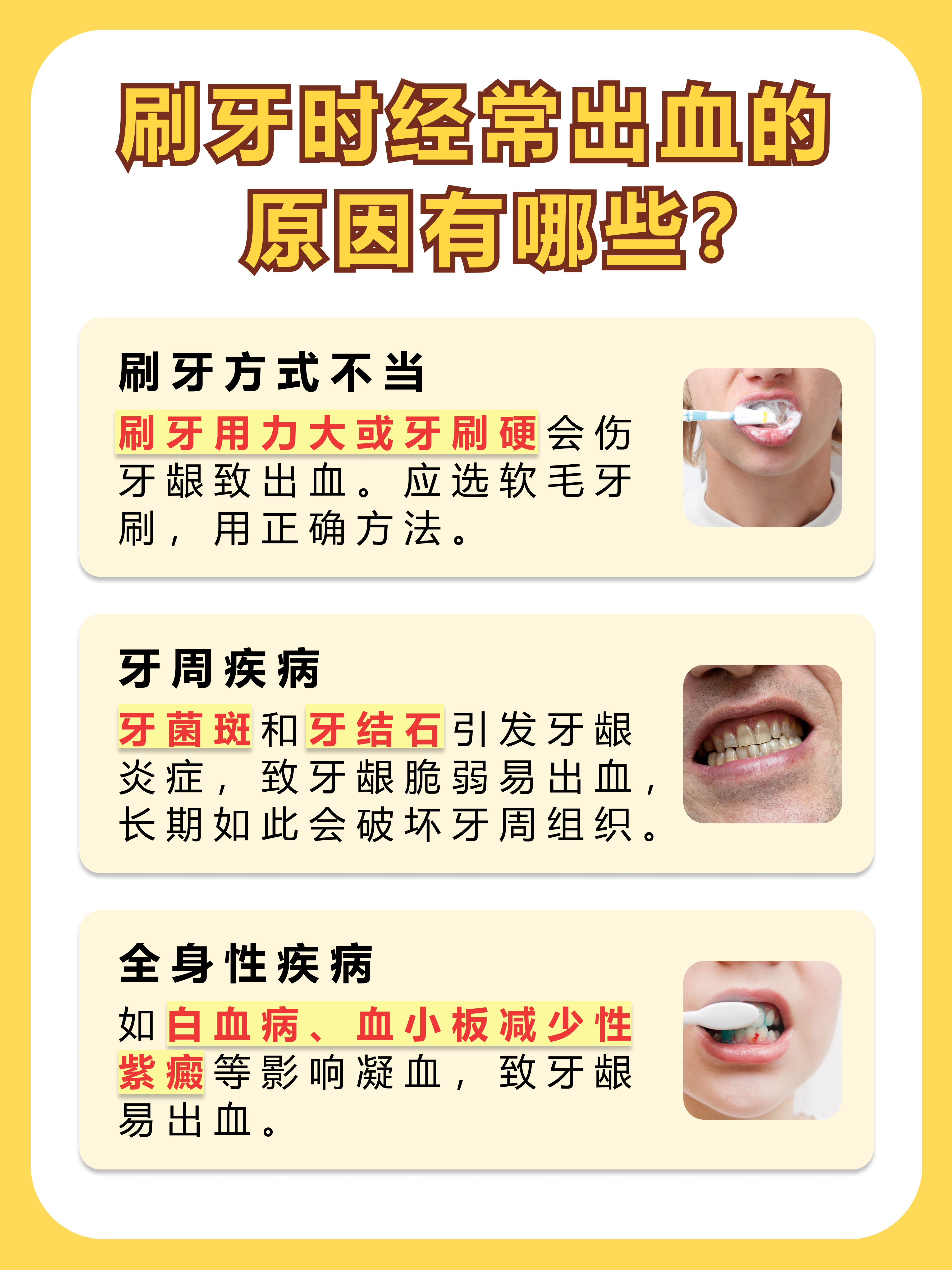 巴氏刷牙法7步骤图解