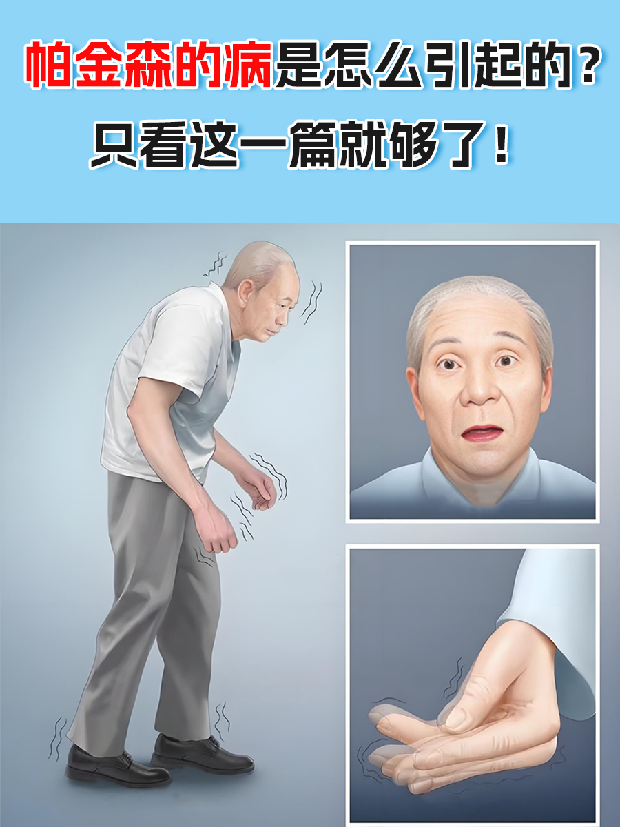 帕金森的病是怎么引起的？只看这一篇就够了！