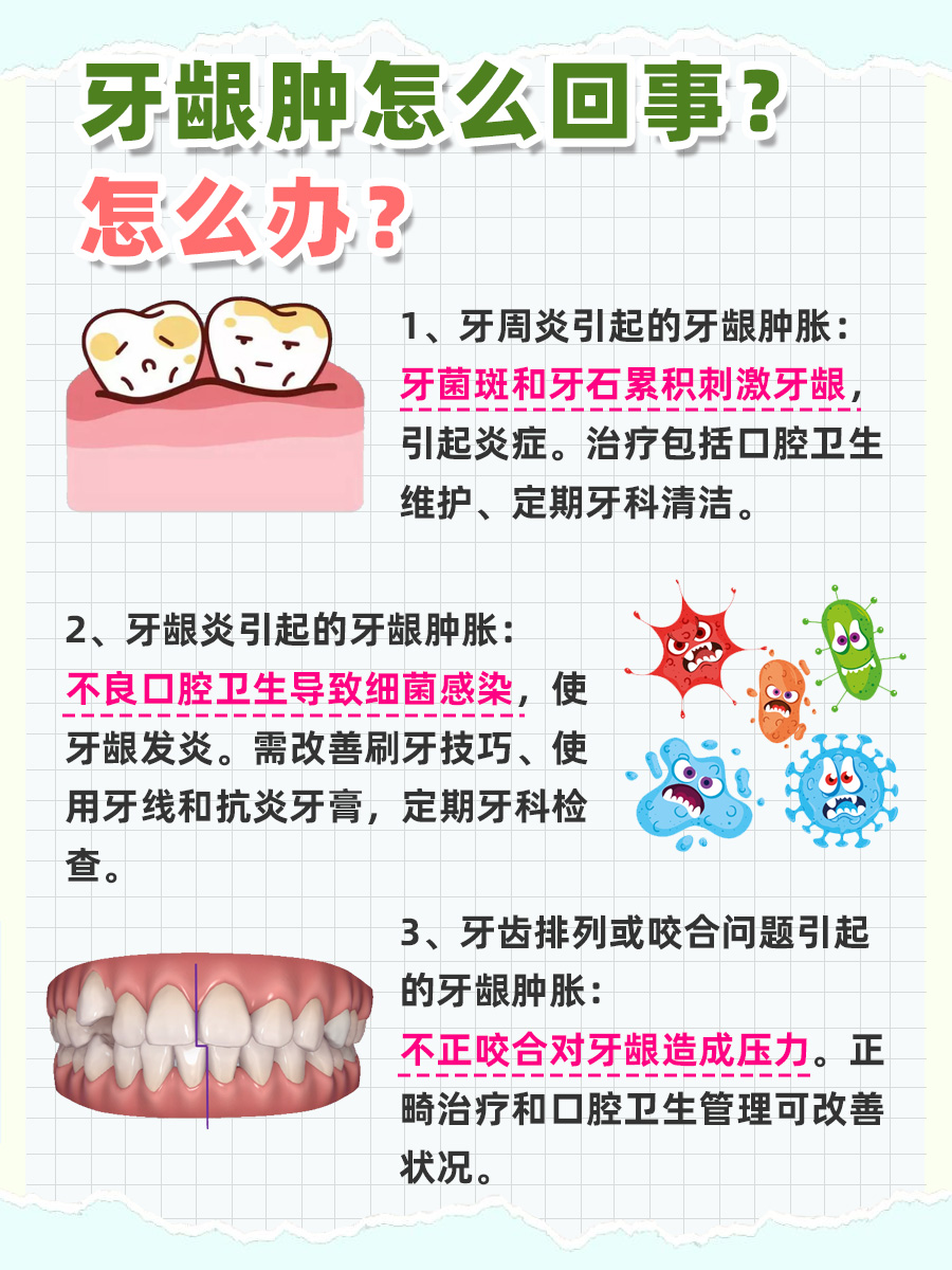 医生带你了解：牙龈肿，究竟是何原因？如何应对？