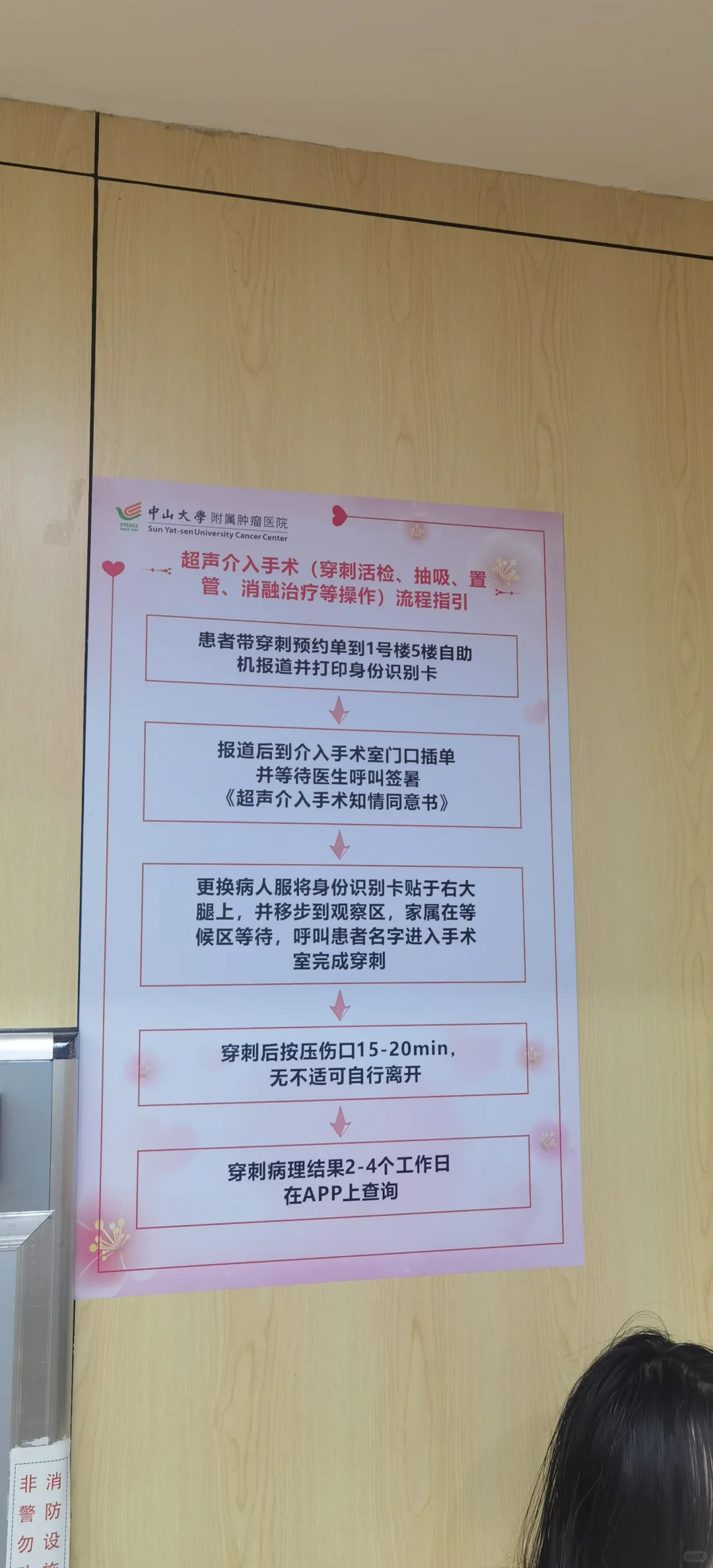 中山大学肿瘤医院淋巴结穿刺检查流程(附图)