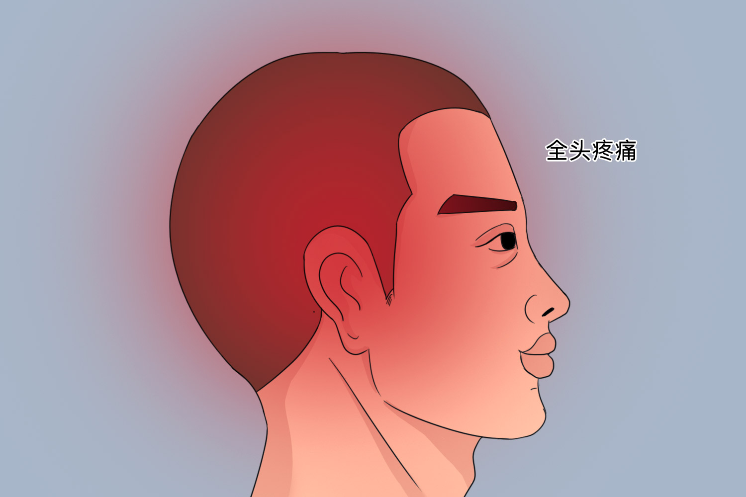 全头头痛图 全头头痛图