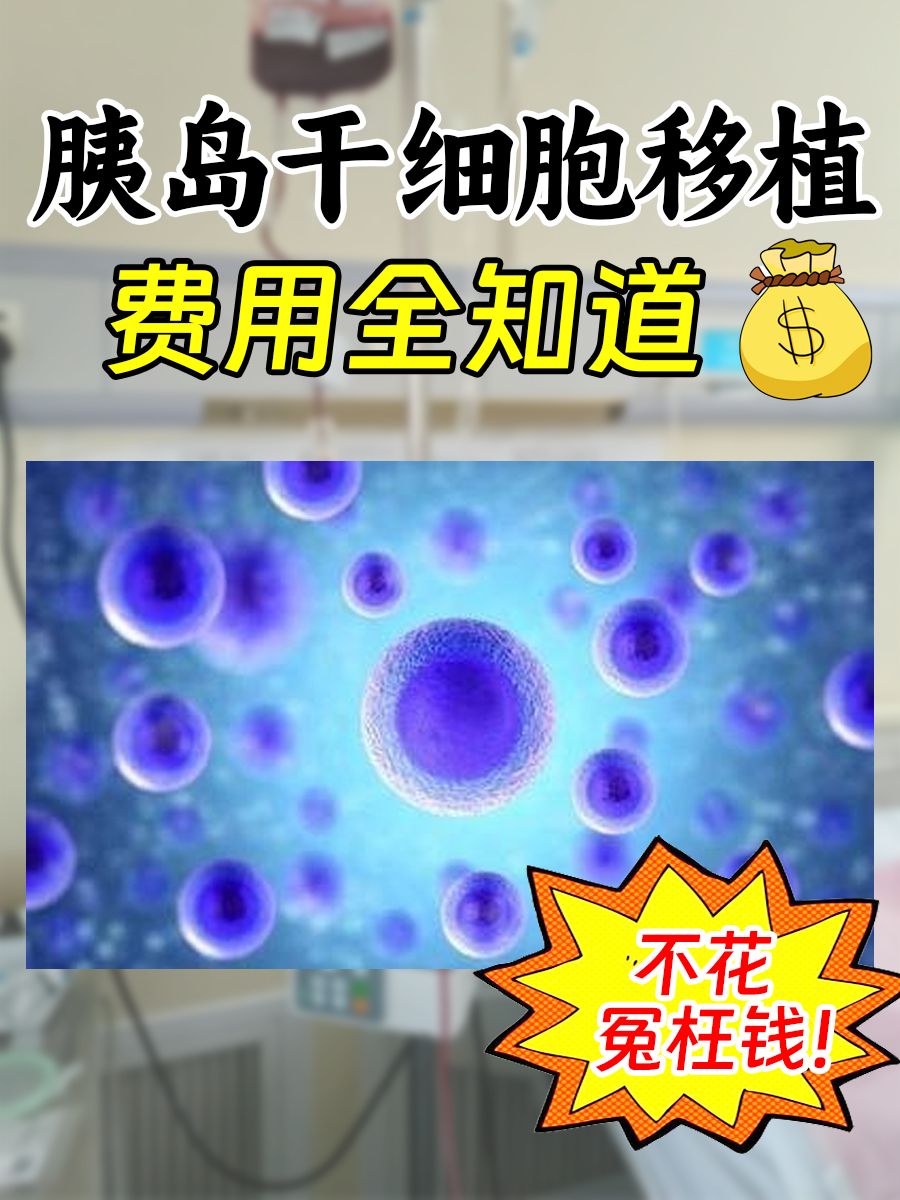 胰岛干细胞移植费用全知道,不花冤枉钱!