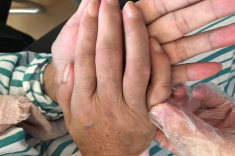 肩手综合征疼痛期手部萎缩活动受限图 肩手综合征疼痛期手部萎缩活动受限图