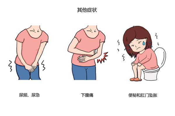如何判断早期宫颈癌