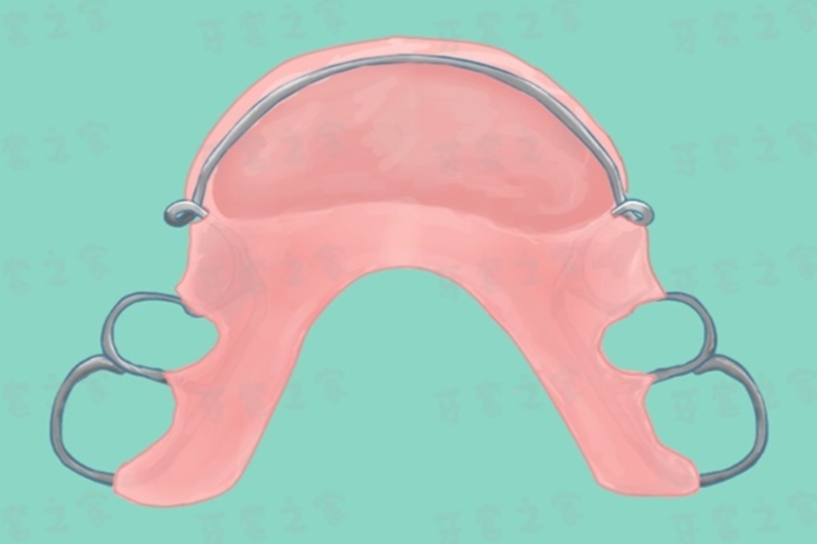 平面导板矫治器图