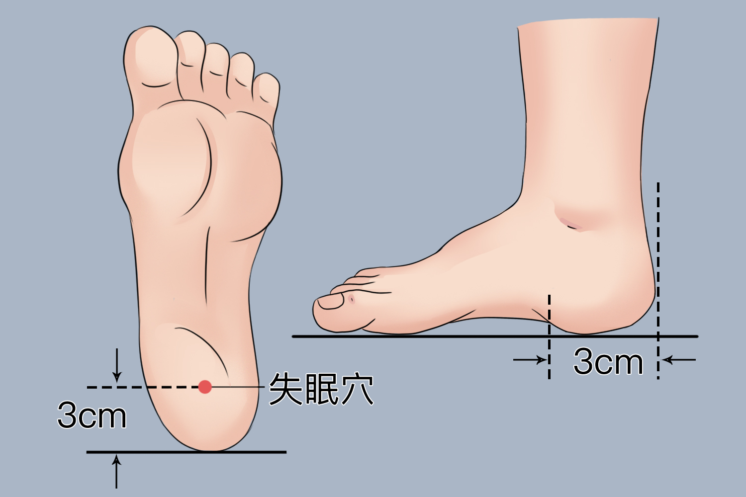 失眠穴位置图