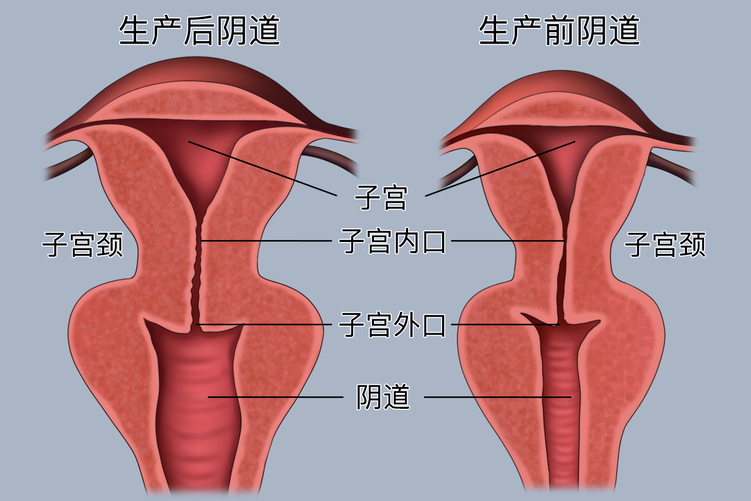生完孩子后阴道变化图 生完孩子后阴道变化图