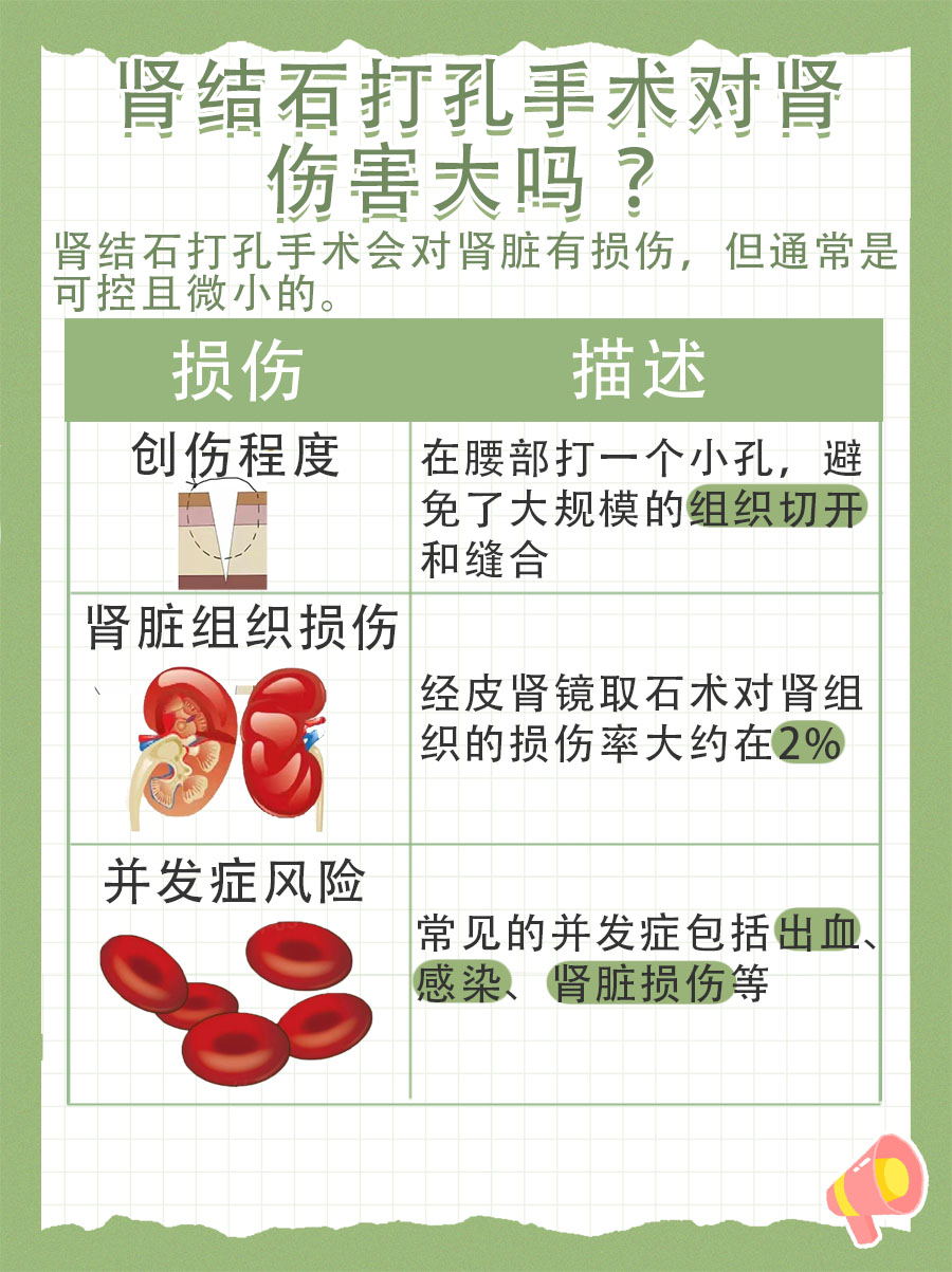 肾结石打孔术:肾伤害揭秘,安全是关键!