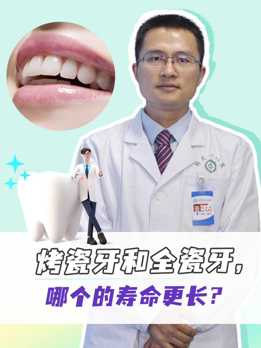 烤瓷牙和全瓷牙，哪个的寿命更长？