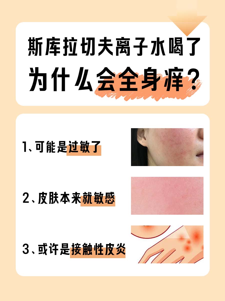 速度戳：斯库拉切夫离子水喝了为什么会全身痒？