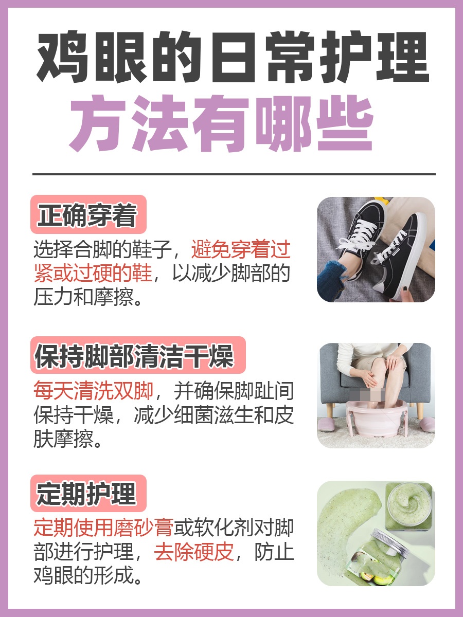 轻松了解鸡眼的成因是什么