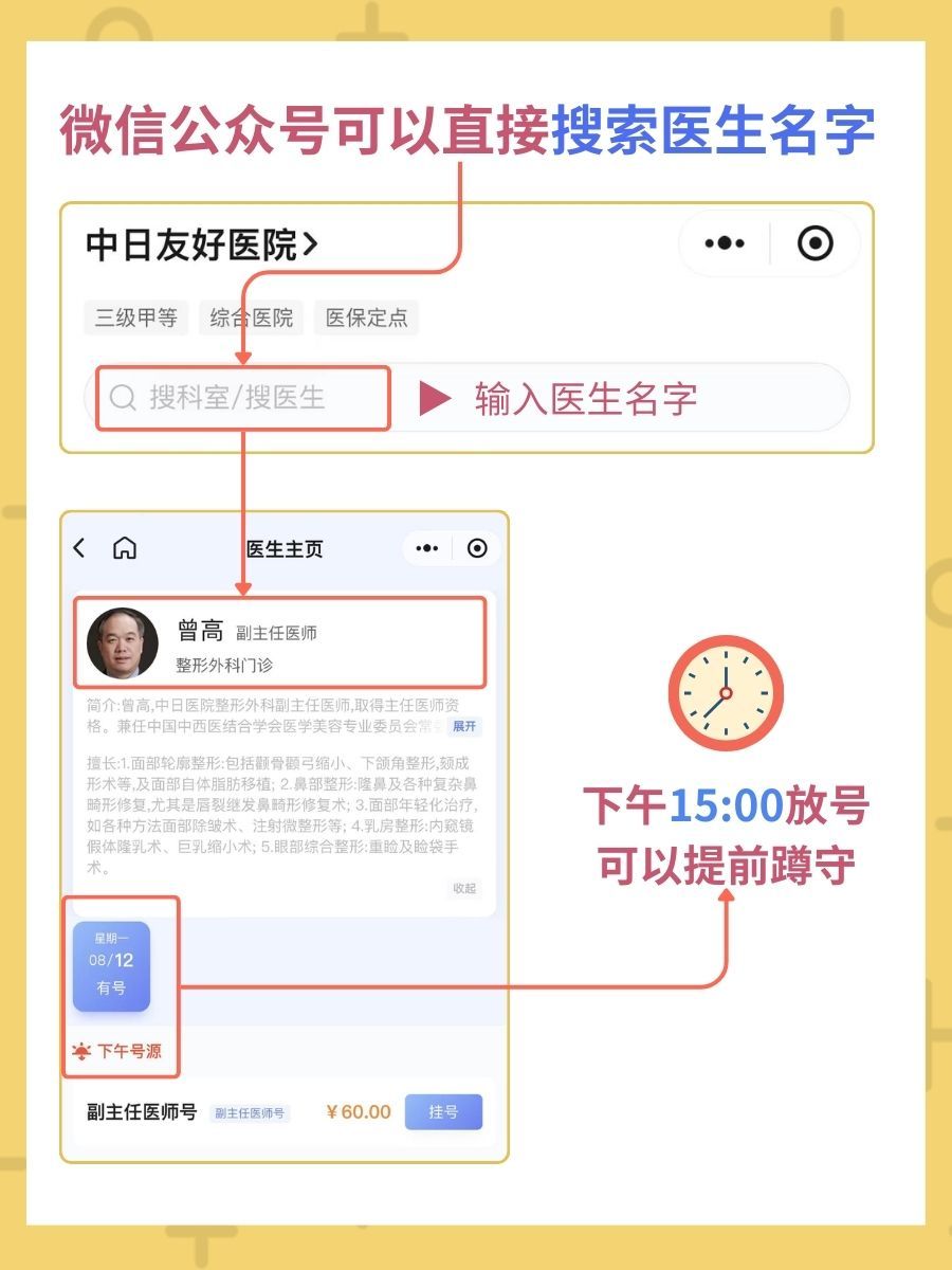 中日友好医院曾高医生怎么样？怎么挂号？