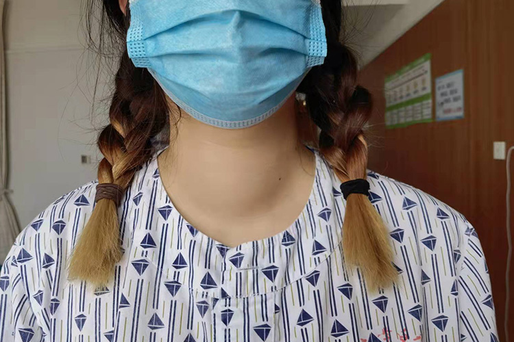 甲状腺Ⅱ度肿大图 甲状腺Ⅱ度肿大图