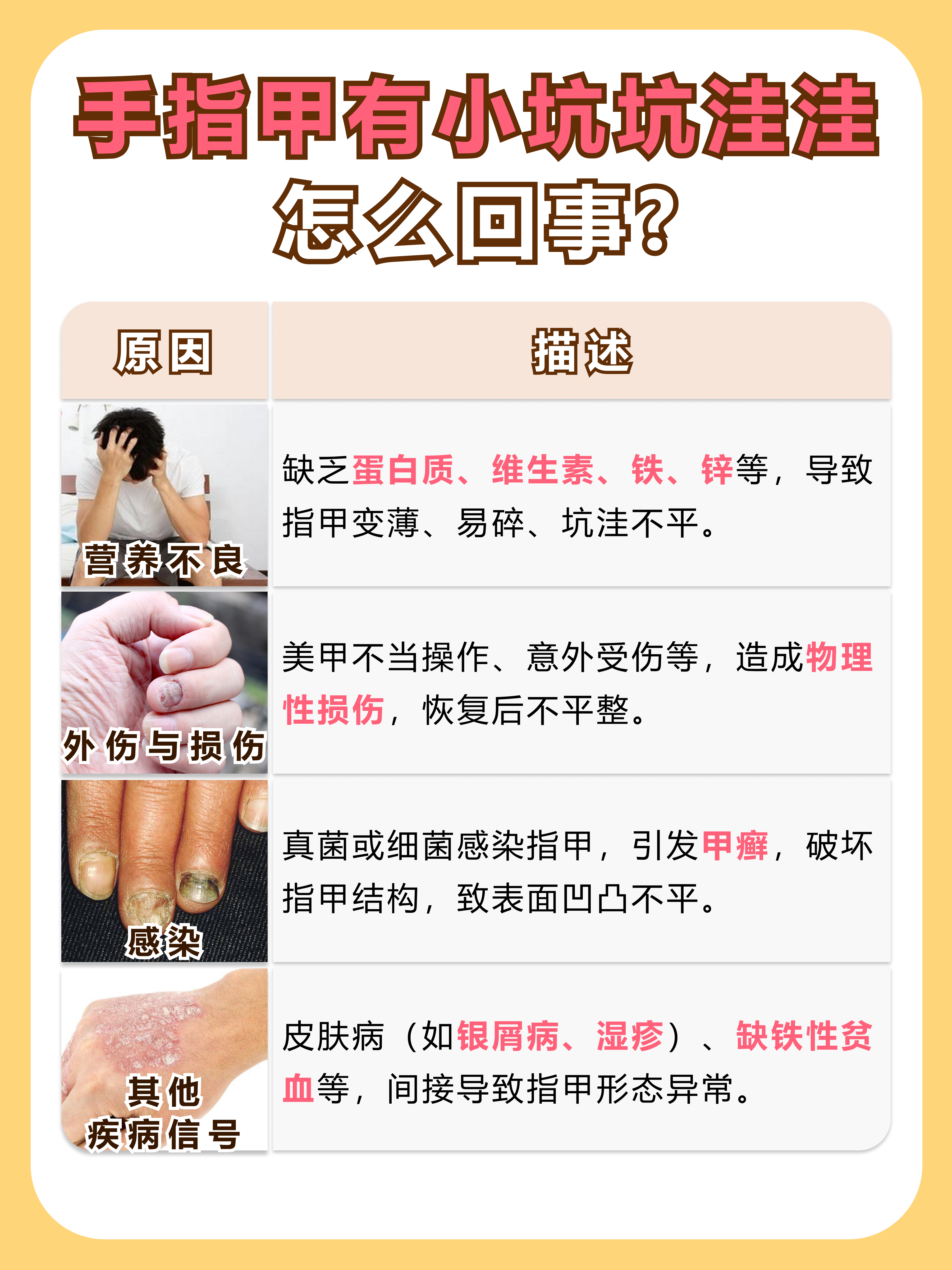 手指甲坑坑洼洼，究竟是何缘由？