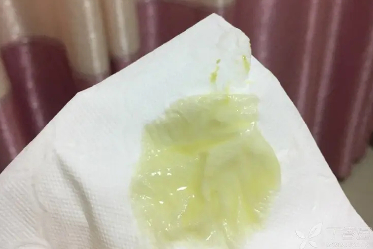 黄水样白带图