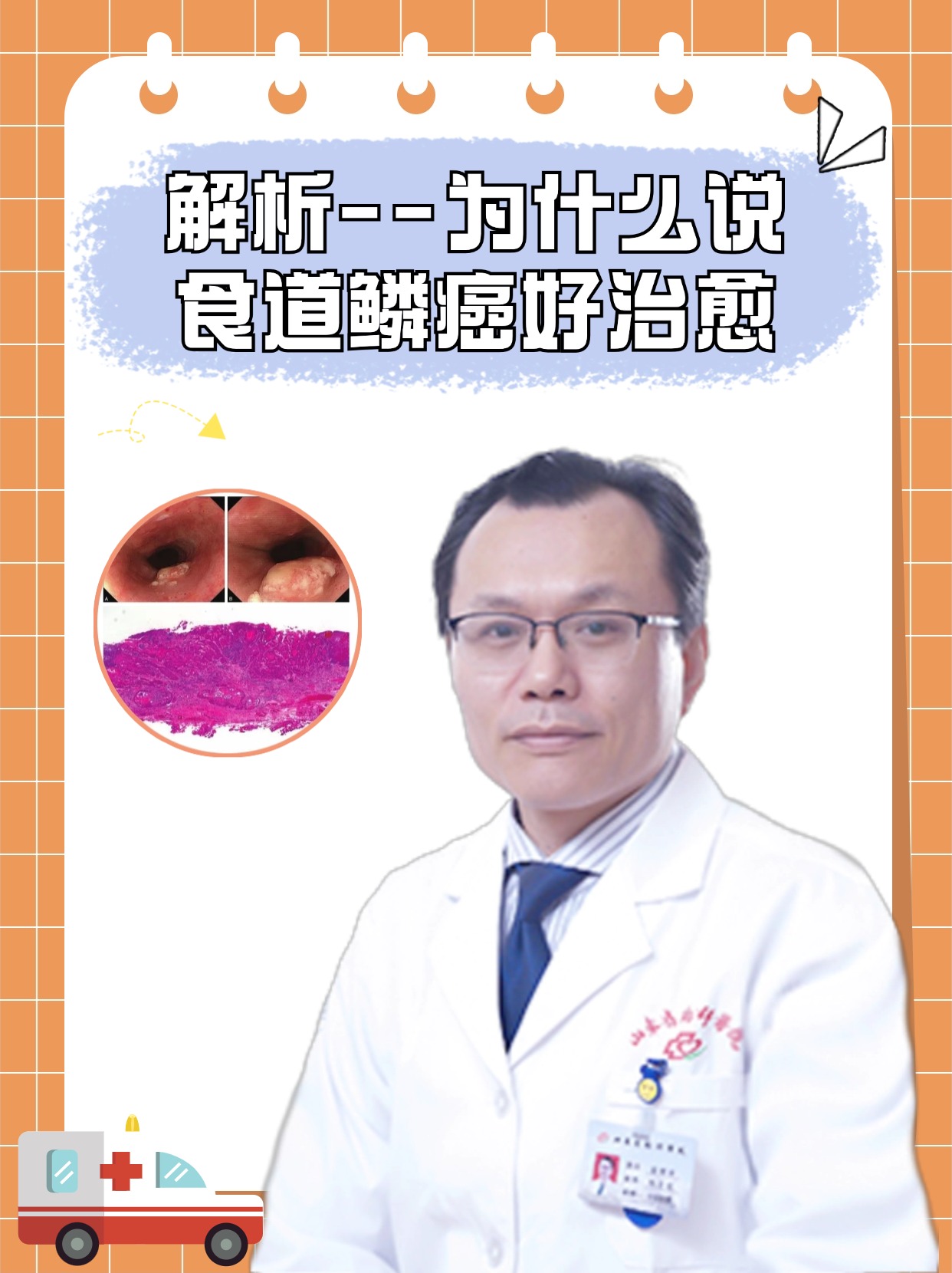 解析--为什么说食道鳞癌好治愈